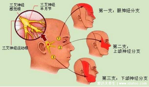 十二級疼痛排行榜牙疼僅排第五，三叉神經(jīng)痛又稱天下第一痛