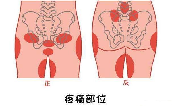 恥骨是哪個(gè)部位圖片，大腿根部和小腹交界的位置(孕婦必看)