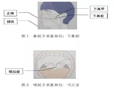 為什么要做鼻拭子不做咽拭子，鼻拭子準(zhǔn)確率更高(都能有效檢測)