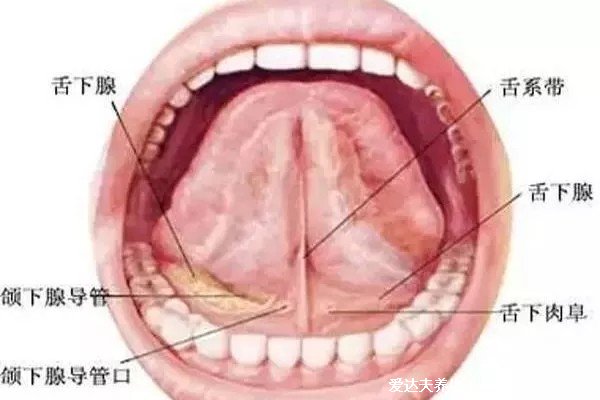 口腔舌系帶疣體圖片，有數(shù)個豆大菜花狀疣體(聲音可能會嘶啞)