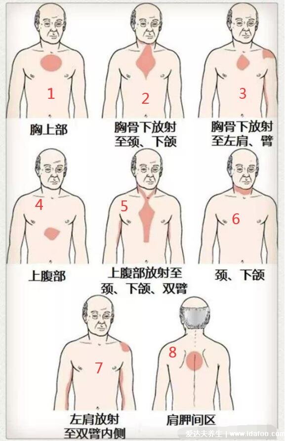 心梗的十大前兆，警惕全身多處疼痛(附心臟疼痛的位置圖片)