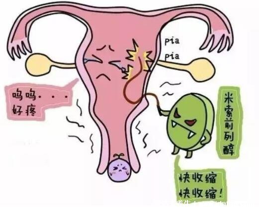 藥流10個(gè)人有9個(gè)流不干凈，不是說(shuō)不能成功(最佳時(shí)間要注意)