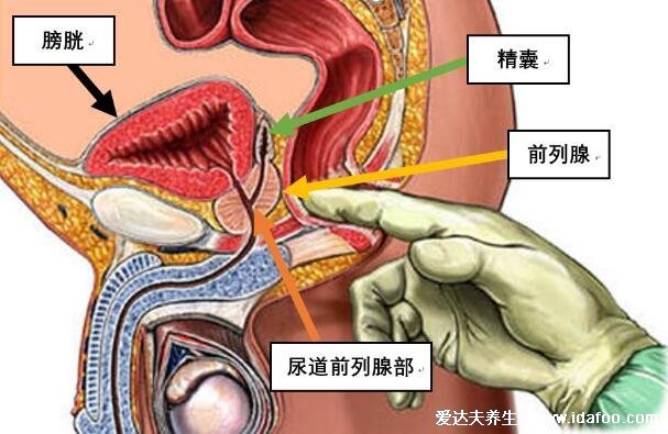 前列腺炎一杯水自測(cè)方法不科學(xué)，教你對(duì)比癥狀自測(cè)更靠譜