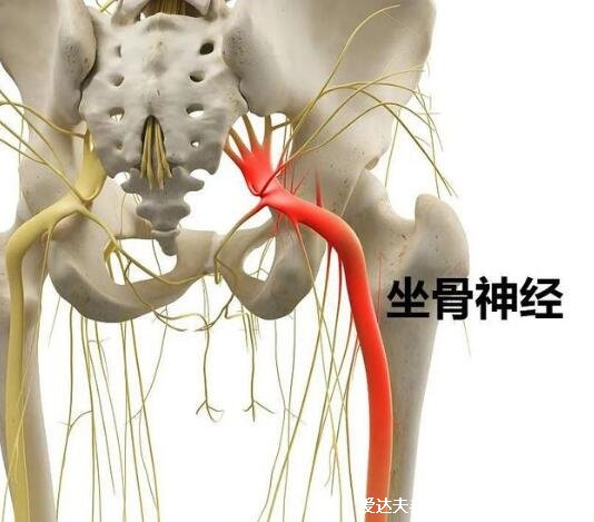 坐骨神經(jīng)痛的疼點圖，多是腰突導致且臀腿一側(cè)疼(附正確睡姿圖)