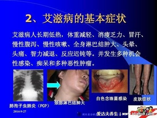 世界上十大必死病圖片，狂犬病病死率接近100%(心腦血管死亡率高)