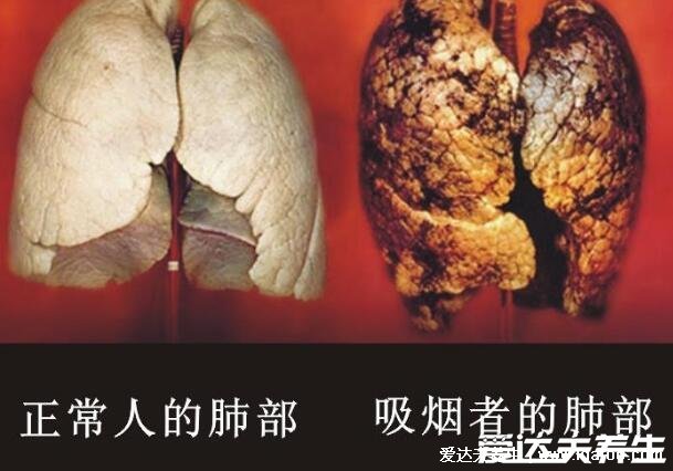 悅刻和真煙哪個(gè)危害大，不含焦油真煙危害大但都有尼古丁