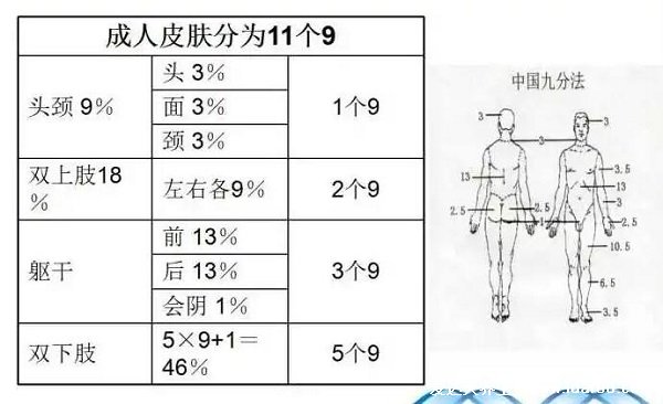 燒傷面積口訣三三三五六七，步步解析數(shù)字詳細(xì)意思(頭面頸3%) 