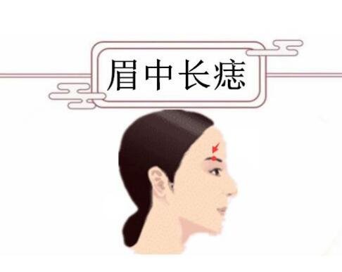 女人痣相圖解臉上，眉毛有痣是富貴命(有些痣必須點掉)