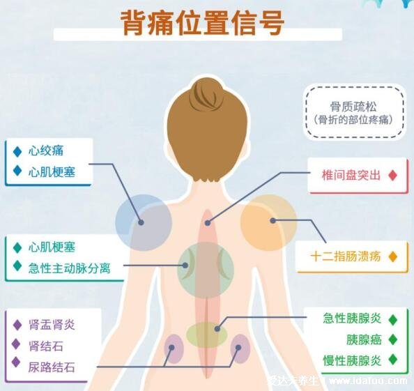 后背疼痛要警惕的三種病，小心后背偏下消化系統(tǒng)病(位置示意圖)