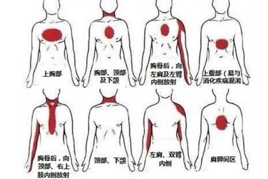 后背疼痛要警惕的三種病，警惕頸椎病/風(fēng)濕病/心臟問題