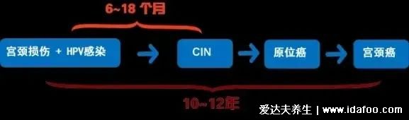 感染HPV病毒 就會(huì)惡變成宮頸癌嗎？造成宮頸癌的真正原因究竟是什么？