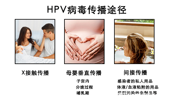 感染HPV病毒 就會(huì)惡變成宮頸癌嗎？造成宮頸癌的真正原因究竟是什么？