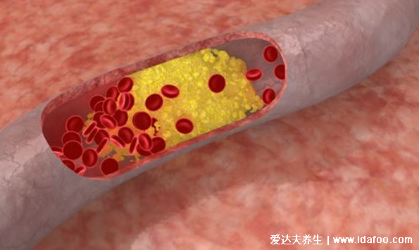 你還在減肥？體重低當心 5種病找上門