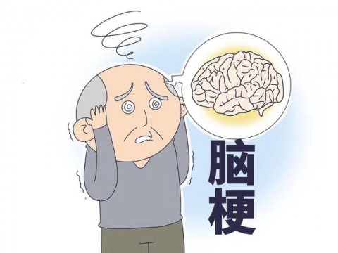 中國腦梗發(fā)病率高罪魁禍?zhǔn)滓丫境?種蔬菜要少吃