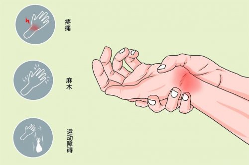 4種大病都是從手麻開始的別以為甩甩就沒事了