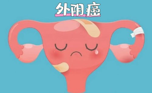 23歲女子確診外陰癌5個壞習慣要盡早改