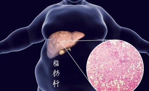  4個穴位每天揉一揉輕松化掉脂肪肝